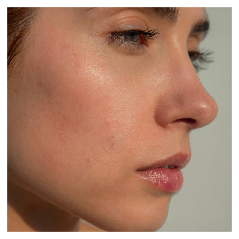 Atmosphera Clarify Patch™ - Blemish Patches with Hydrocolloid Lifestyle
